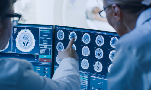 MRI and CT scans