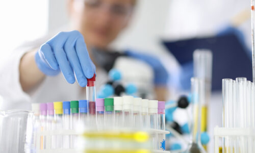 PSA Test
