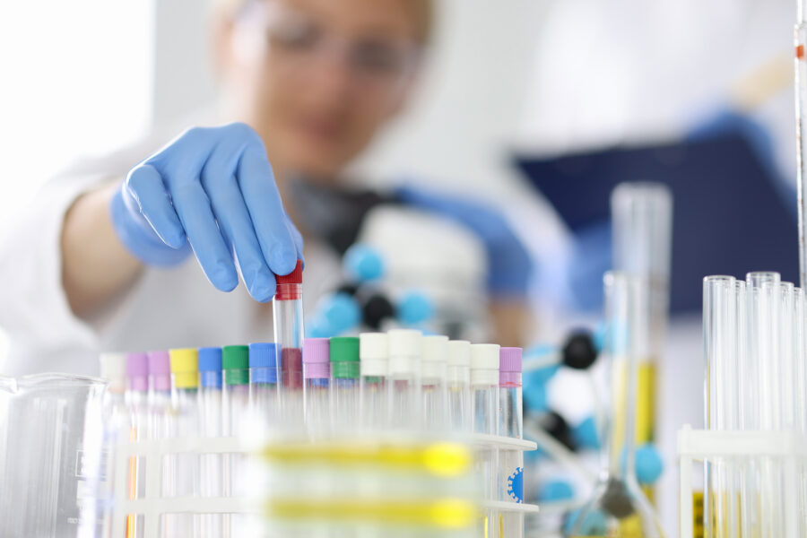 Member article: PSA test added to Health Check choices under Equipsme plans
