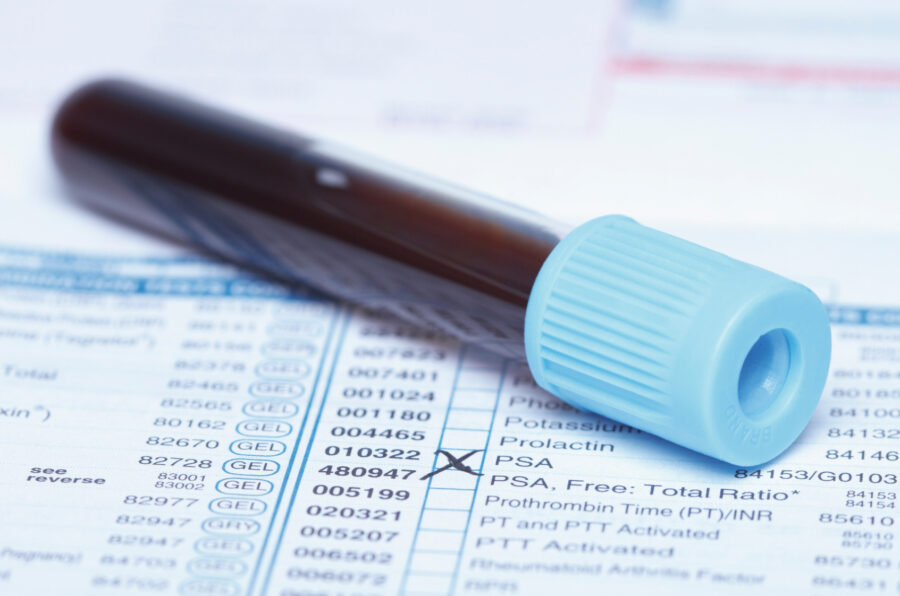 Company article: PSA test added to Health Check choices under Equipsme plans